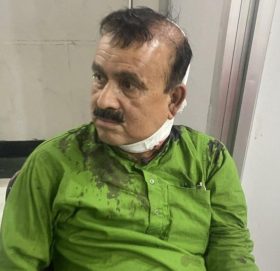 कांग्रेस सहमहामन्त्री यादवमाथि सांघातिक आक्रमण, ट्रमा सेन्टर लगियाे