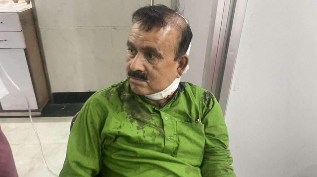 कांग्रेस सहमहामन्त्री यादवमाथि सांघातिक आक्रमण, ट्रमा सेन्टर लगियाे