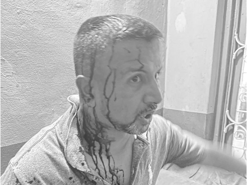 युवा संघ पर्वतमा झडप हुँदा एमाले प्रदेश सदस्य घाइते