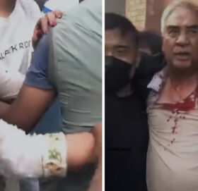 कांग्रेस सभापति देउवाको गर्धनमाथि गम्भीर चोट, टाउकोमा १२ वटा टाँका